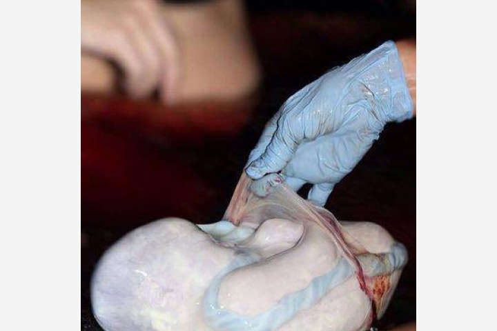 10 fotos impressionantes de bebês nascidos em um saco amniótico