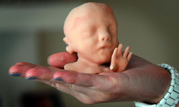 Obtenha um modelo 3D do rosto do seu bebê por nascer