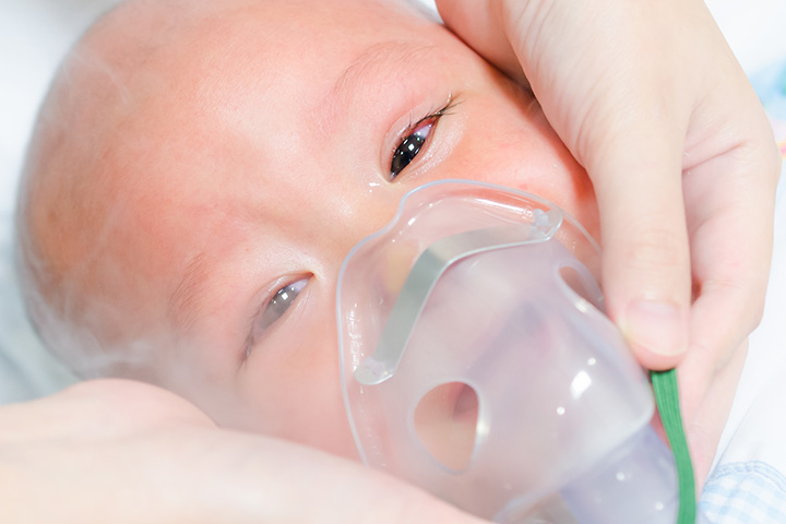 'Taquipneia transitória do recém-nascido': 5 sintomas e 5 tratamentos para conhecer